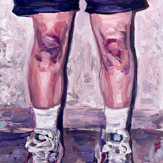 bruised knees